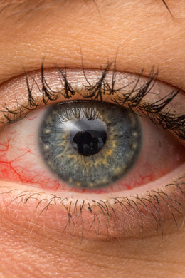 Allergie oculari: alcune curiosità