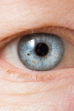 Glaucoma: come una visita può salvarti la vista