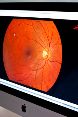 Monitorare la salute della cornea e della retina attraverso la Tomografia a Coerenza Ottica (OCT)